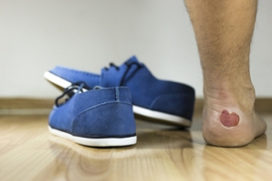 Blisters and Basketball