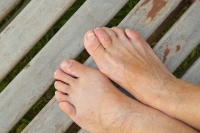 Two Types of Hammertoe